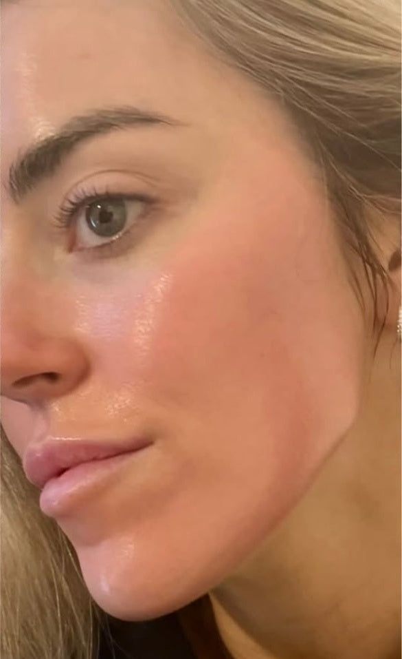 After — Customer
